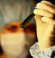 nola probatu parasitoak